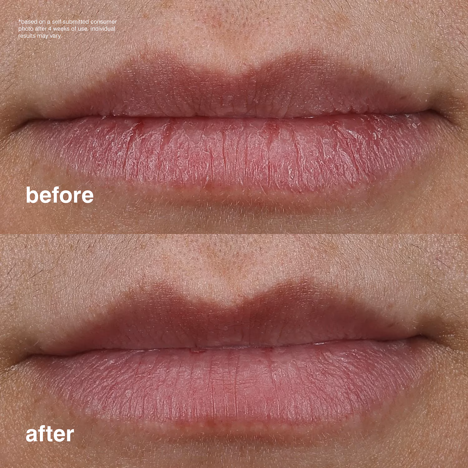 rhode Peptide Lip Treatment – Glaze nutritivo (10 ml) 5